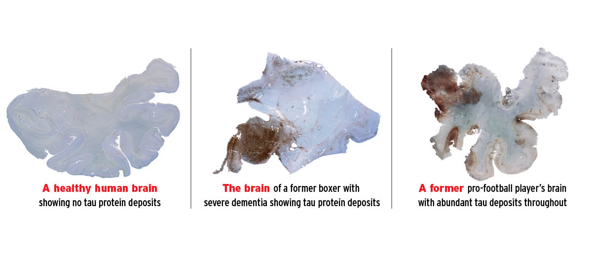 three scans of different brains